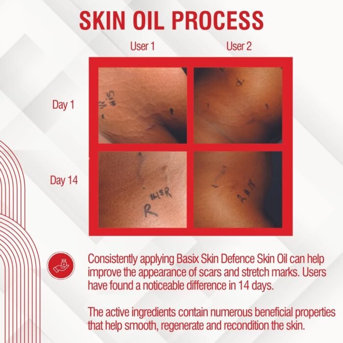 Basix Skin Defence Clear Skin Tissue Oil - Image 4