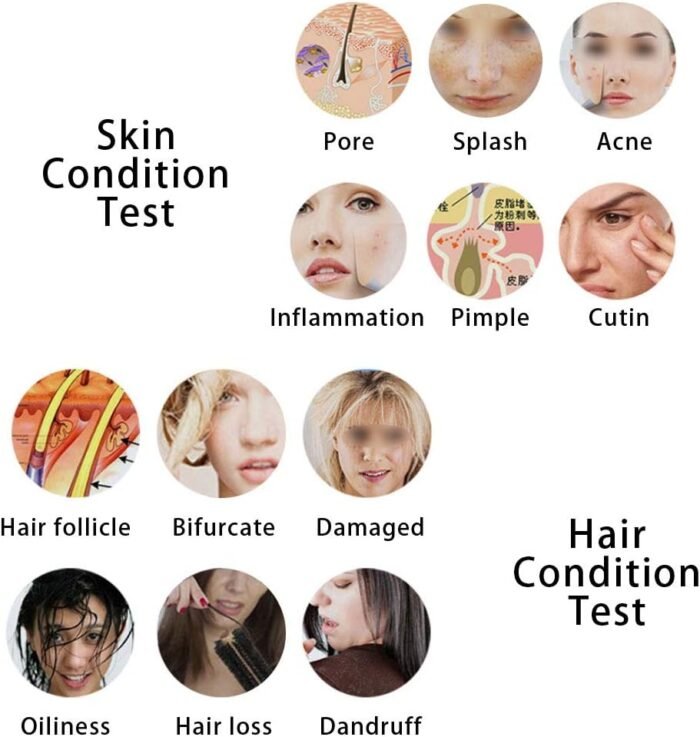 Skin Hair Analyser,5 in 50X/200xLens LCD - Image 6