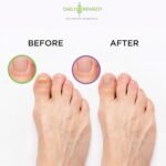 DAILY REMEDY 4-Pack - 2 Extra Strength T - Image 6