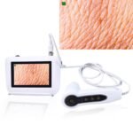 Skin Hair Analyzer, 5 Inch HD Screen Rec - Image 8