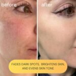 KOA LIFE Facial Oil and Vitamin C Serum - Image 3