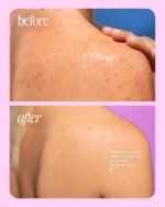 Truly Beauty Cherry Jelly Body Acne Wash - Image 8