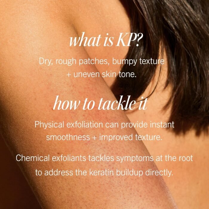 First Aid Beauty - KP Bump Eraser Body S - Image 4